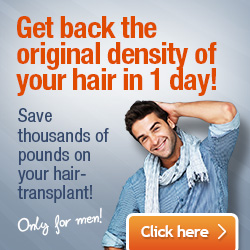 Hair transplant UK cost