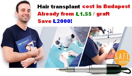 Hair transplant cost in London 2019